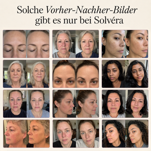 Solvéra 4-Phasen Intensivpflege für reife Haut
